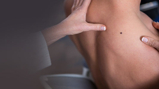 Massage Therapy and Skin Cancer: A Closer Look with Ruth Werner