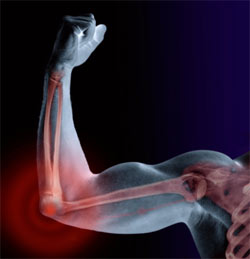 Fascia: The Big Picture